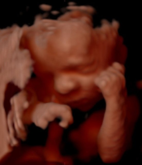 Fasulye halinden itibaren ay ay bebeklerindeki gelişimi görebilen aileler, adeta bebeğin anne karnındaki fotoromanını oluşturuyor.