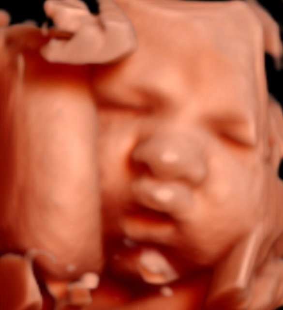 Bebeğin anne karnında fotoromanı Türkiye'de 3-4 yıldır kullanılan 4 boyutlu ultrason sayesinde anne ve babalar, bebeklerinin fotoğraf albümlerini anne karnında iki aylıktan itibaren oluşturmaya başlıyor.