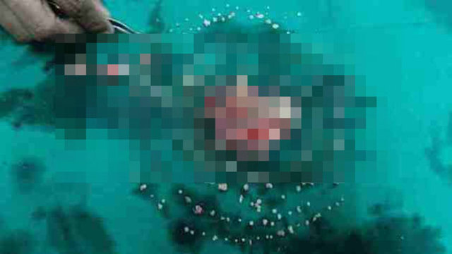 Eğer birisi size ağzında 232 tane diş olduğunu söyleseydi inanır mıydınız?