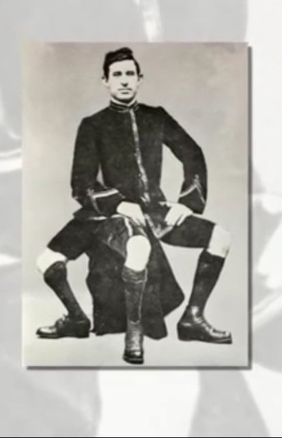 Franchesko Dantini 1889 yılında dünyaya üç bacak ve iki kalple geldi.