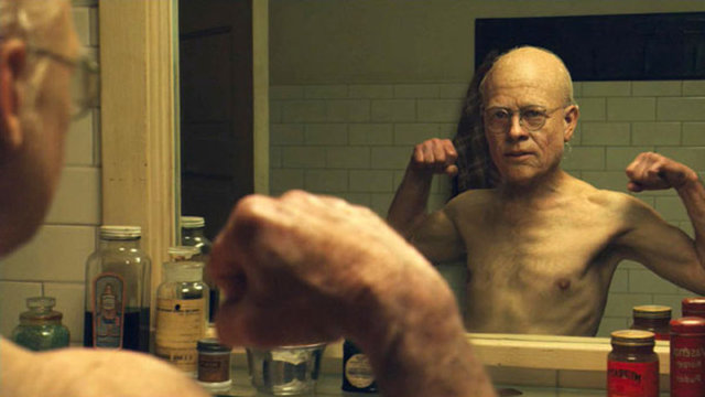 Benjamin Button'ın tuhaf hikayesi de bu hastalıktan yola çıkılarak hazırlandı.