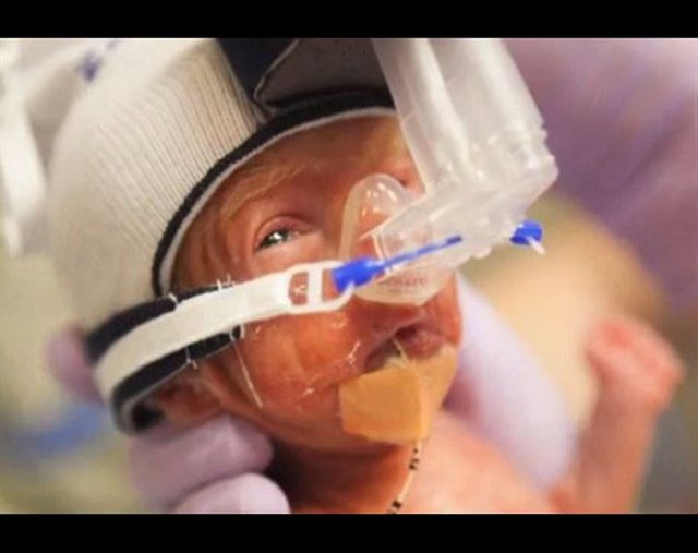 5. gününde -  - Kendi başına nefes alamıyordu