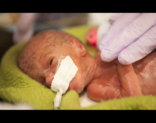 Sadece 500 gram ağırlığında -  - Walker 25 Nisan'da erken doğdu.