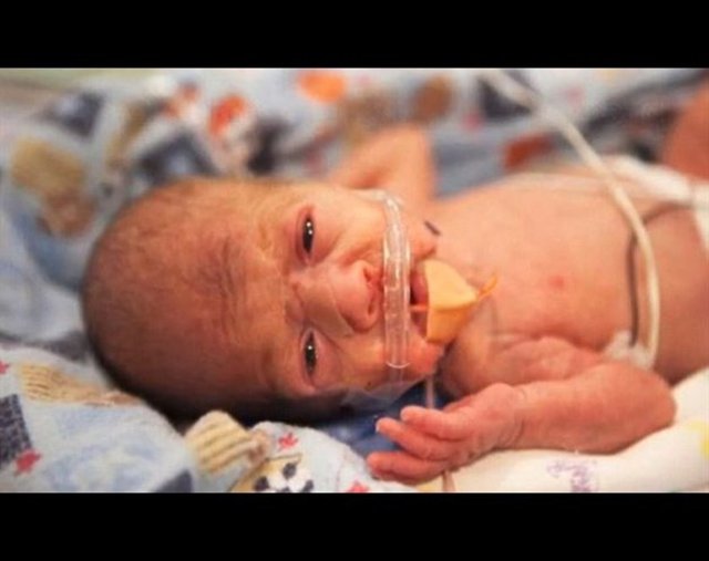 Hayatın 27. gününde -  - Biraz daha sağlıklı