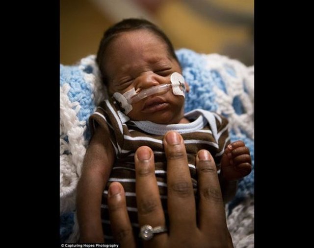 Adı Nuh, doğduğunda sadece 878 gram ağırlığındaydı -  - O şimdi 5 aylık ve 6.3 kg ağırlığında