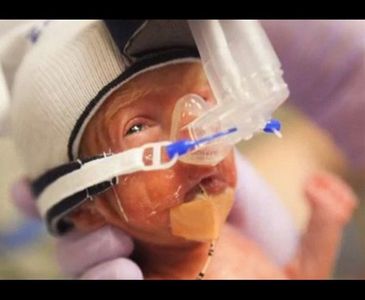 ERKEN DOĞAN BEBEKLERE UMUT VEREN FOTOĞRAFLAR