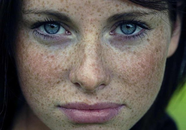 Güneşten gelen ultraviyole ışınları, sadece 5 dakikalık bir sürede melanin üretimini tetikliyorve bu üretimin tam 36 saat boyunca devam etmesine neden oluyor.Ayrıca 72 saat sonra yine ciltte artan bir pigmentasyon dalgası oluşuyor.