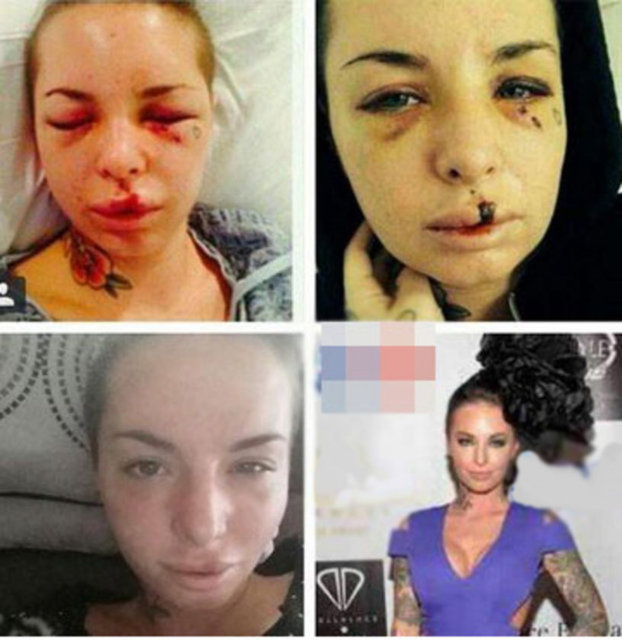 Instagram hesabında bir kolaj yayınlayan Mack, karelerden ilkinin saldırıdan iki gün sonra, diğerinin iki hafta, üçüncüsünün dört hafta, sonuncusunun da Cumartesi günkü bir etkinlik sırasında çekildiğini belirtti.