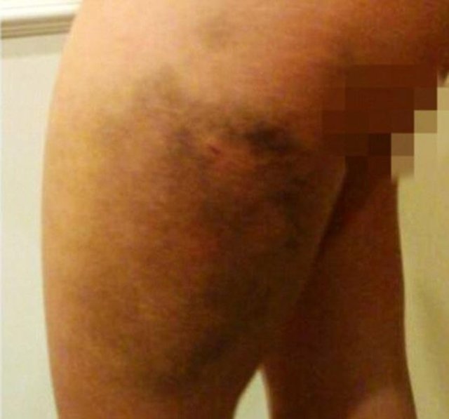 Mack, olayın ardından yaptığı açıklamada, "Koppenhaver'la Mayıs'ta ayrıldık ve evimden San Diego'ya taşındı. Cuma sabahı habersiz şekilde evime geldi. Eve geldiğinde, ben ve arkadaşım giyinik ve silahsızdık.