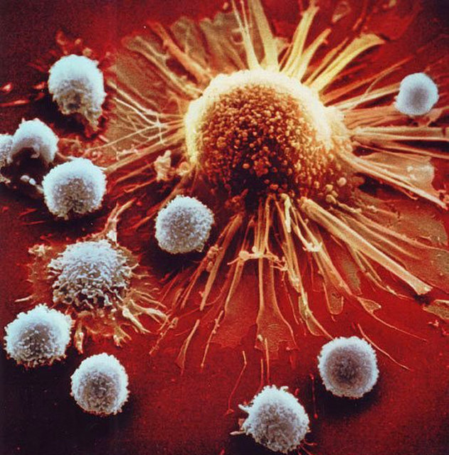 Vücuttaki sağlıklı hücrelerin bir şekilde mekanizmanın dışına çıkıp kanseri meydana getirmesine sebebiyet veren isyan. Neyse ki, dış yüzeylerindeki antijenler bu kendi kendilerini değiştirebilen hücreleri yavaşça kontrol edebiliyorlar.