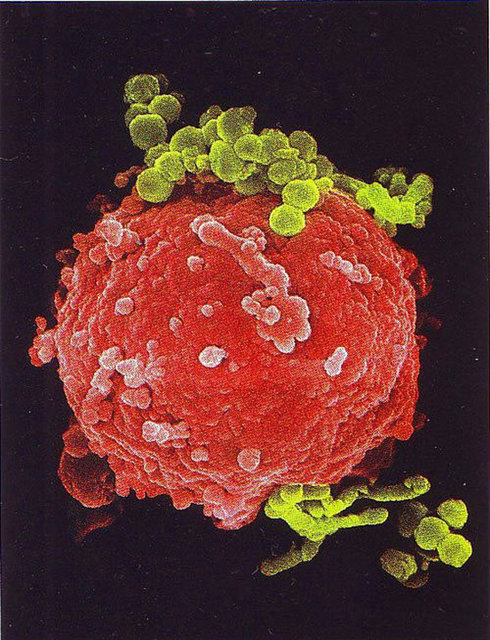 Bakteri ile kaplı örnekte görüldüğü gibi, tek bir cins patojene saldırmakla görevli olan antikorlar ordusu üreten B hücresi.