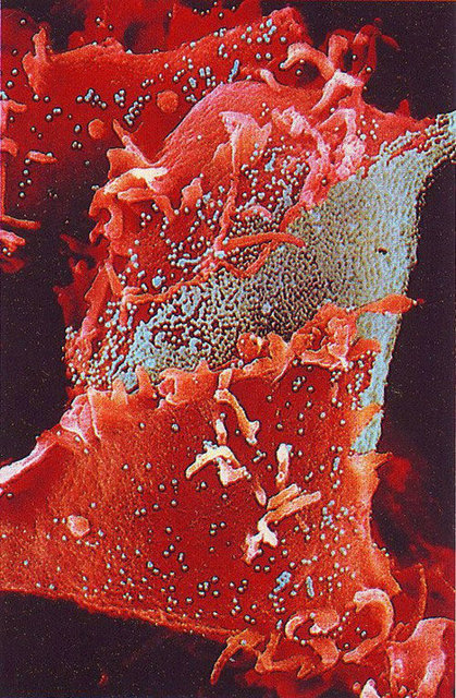 Genel bir grip virüsü tespit edilmemek için sürekli mutasyon geçirir. Mavi olarak gözüken şeyler sağlıklı hücrelere saldıran grip virüsleridir.