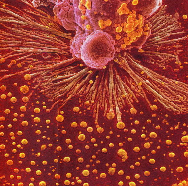 Dokularda bulunan patojenlerin, ölü gözelerin, hücresel kalıntıların ve vücuttaki yabancı maddelerin yutulmasından sorumlu hücre olan "Makrofaj" -