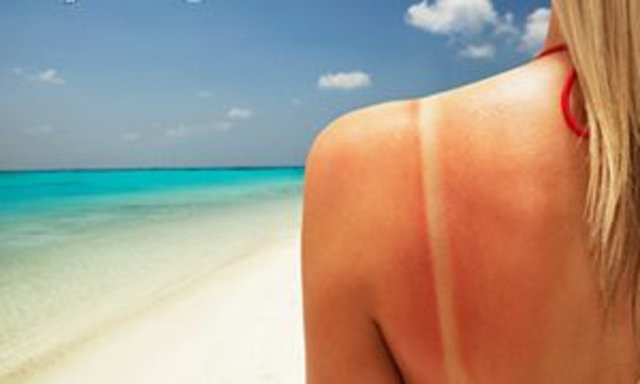 "Ayrıca güneş ışığına maruz kalmaya bağlı olarak deride 'büller' diye adlandırılan şişlikler, kızarıklıklar, su dolu cilt kabarcıkları oluşabiliyor