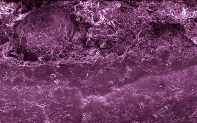 Soğuk algınlığından korunmanızı sağlar, peki nedir bu?