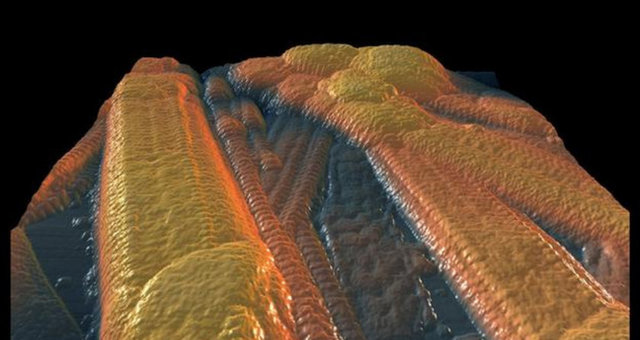 İnsan derisinden alınmış kollajen lifler.