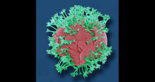 Plankton ya da okyanusların üst tabakasında yaşayan tek hücreli deniz bitkilerinden biri.