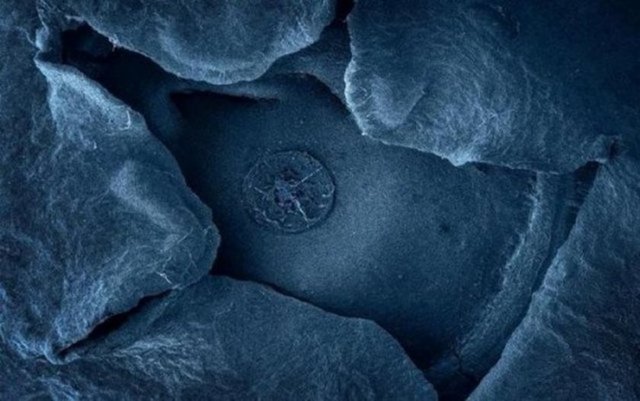 Ülkemizde pek bilinmeyen bir tür meyve...