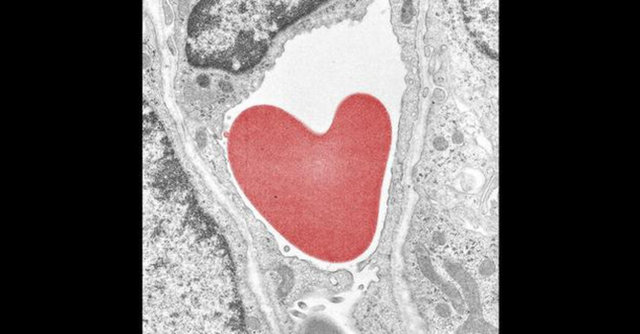 Bir kılcal damarda kalp şekli almış bir kırmızı kan hücresi.