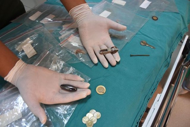 Çocuğu yalnız bırakmamak gerekiyor. Çok güçlü mıknatıslar var, bunları sayıca fazla ya da metal cisimle yuttuklarında bunlar da birbiriyle yapışıp ciddi hasarlara yol açabiliyor.