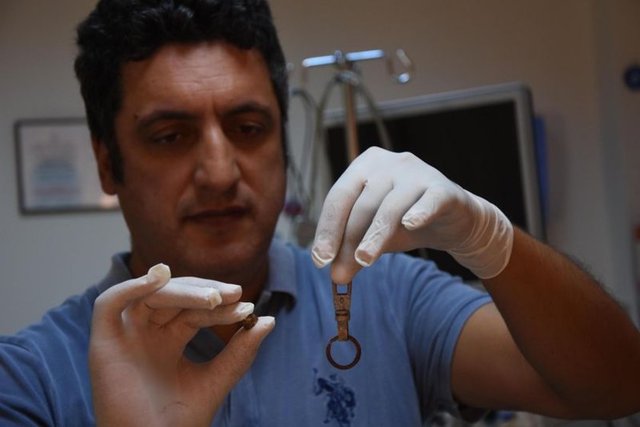 Piller kimyasal mekanizmayla mukozayı yakıyor, özellikle yemek borusu çok duyarlı pillere, hele ki yeni takılmış bir pilse saatler içinde şahit olduğum bir kaç vaka var, yemek borusunu kömür haline getirebiliyor. Söz konusu cisimlerin yutulması durumunda en yakın sağlık kuruluşuna başvurulması gerekiyor."