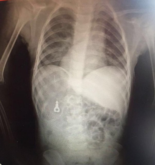 "Çocuklar 6 aydan sonra oral dönem dediğimiz ağızlarıyla dilleriyle ve tatla tanımaya başlarlar. Bu dönem 6 aydan itibaren başlar ve 2 yaşına kadar gider, bu süreç bazı çocuklarda uzayabilir. 