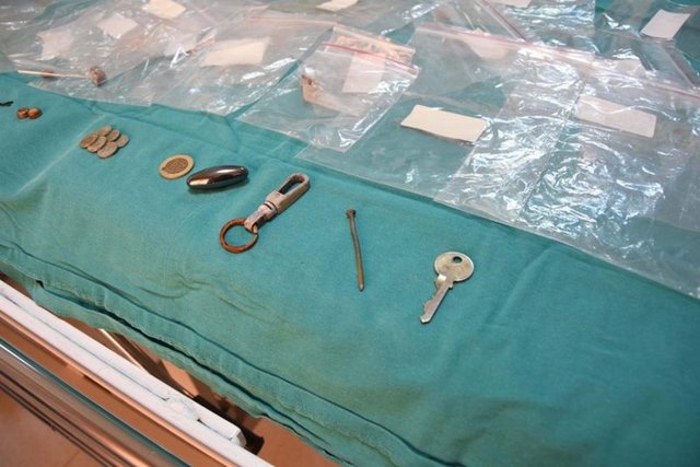 "ÖNCE TAKİP SONRA MÜDAHALE" -   - Hastaneye yabancı cisim yutma şikayetiyle getirilen çocuğun ilk etapta takip edildiğini, yaşına ve yuttuğu objenin özelliğine göre de müdahaleye karar verildiğini belirten Dr. Miray Karakoyun, yabancı cisim yutma şikayetiyle başvuran hastalarda, yabancı cismin ne olduğu, çocuğun kaç yaşında olduğu ve yutulan maddenin çekilen filmi sonucu sistemin neresinde olduğunun kendileri için önemli olduğunu kaydederek şöyle dedi: