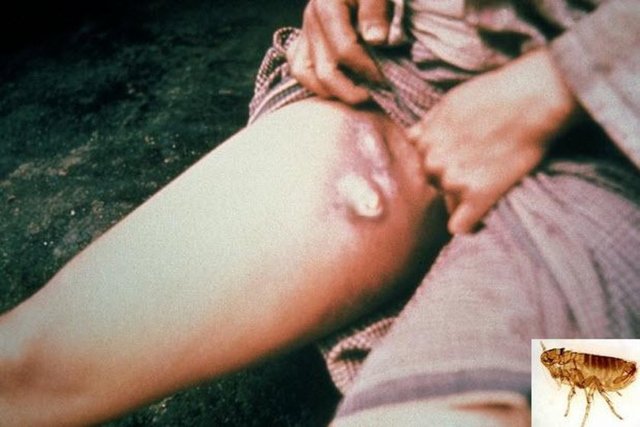 Japonya İkinci Dünya Savaşı sırasında Çin'i zehirli pirelerle bombalamıştır.