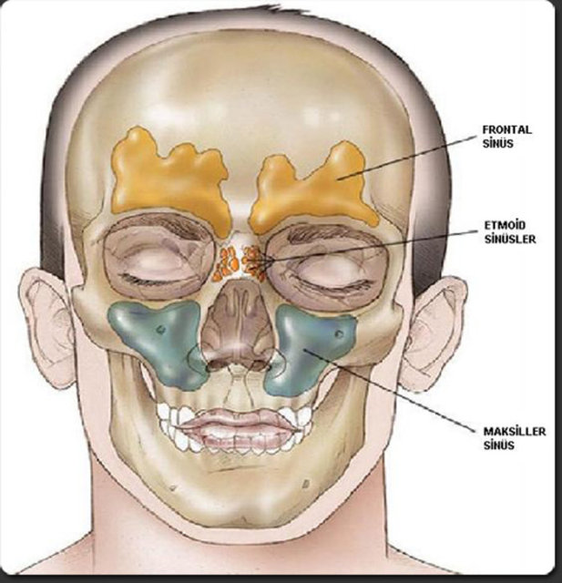 Гайморит глаза. Фронтит и фронтальный синусит. Гайморовы и лобные пазухи. Пазухи черепа фронтит гайморит. Лобный (фронтальный) синусит.
