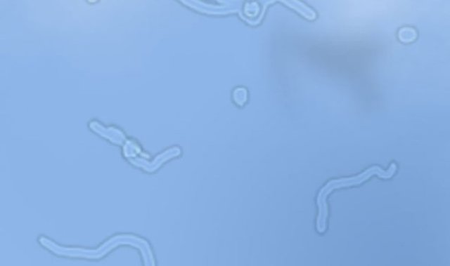 Zaman zaman gözümüzün önünde oluşan ufak şekiller (takip de edilebilen), gözün vitröz sıvısındaki proteinlerin yansımasıdır. -