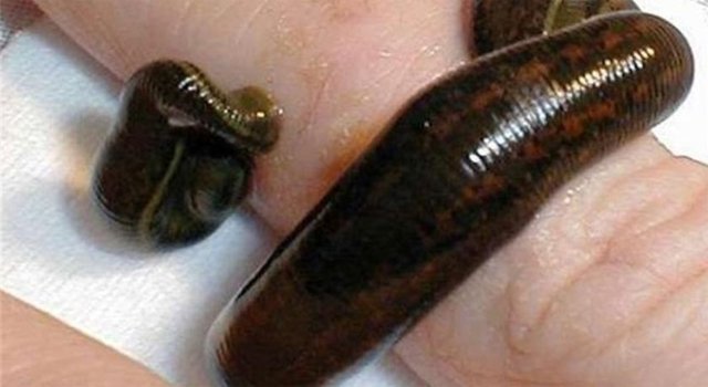 Sülük Toplayıcı: Bazı hastalıkların tedavisinde iyi geldiği söylenen sülükleri toplayıp, doktorlara satan kişilerdi.