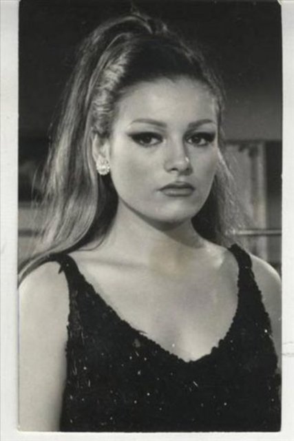 TAM 14 KEZ AMELİYAT OLDU - İşte Ajda Pekkan'ın geçirdiği estetik operasyonların listesi: 3 kez burnunu yaptırdı, 6 kez dudaklarına silikon enjekte ettirdi...