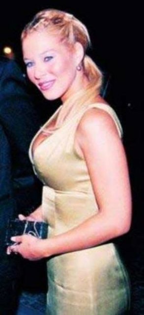 Estetiksiz ünlü güzeller...