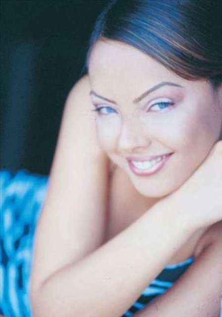 DÜZENLİ BOTOKS - Ebru Gündeş, düzenli olarak yüzüne botoks yaptırıyor.