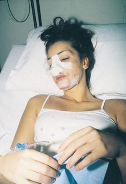 Geçirdiği küçük operasyonlar sonucunda Petek Dinçöz daha güzel bir görünüme kavuştu.