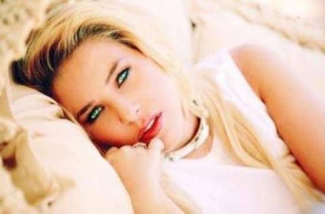 Estetiksiz ünlü güzeller...