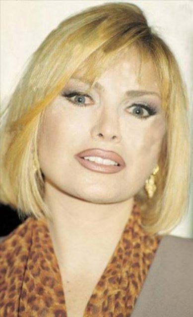 Bunun yanısıra her 6 ayda bir yüzüne botoks yaptırıyor