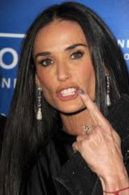 Ünlü yıldızın alnı, neredeyse 20 yıl önceki çekilmiş fotoğraflarındakiyle aynı. Estetik uzmanları, Moore'un alnını ameliyatla gerdirmiş olabileceğini ya da bu bölgeye düzenli olarak botoks yaptırdığını düşünüyor.