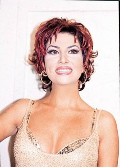 CİLDİNİ TRAŞLATTI - Ebru Yaşar güzellik uğruna tam 5 kez ameliyat geçirdi.