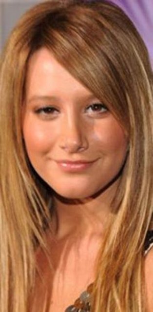 Bir de şimdi bakın. Burnundaki usta işi estetik operasyonu fark etmemek olası değil.