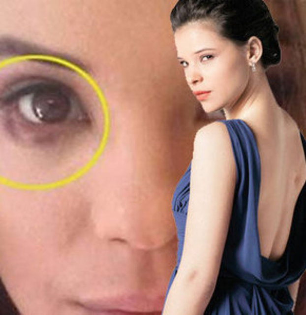 Bir dizinin başrol oyuncusu Selen Seyven, gözünün mor olduğu bir fotoğrafı Instagram'dan paylaşmış ve altına, "Iş ahlakı böyle bir şey işte. Gözün çıkıp eline düşse bile çekersin sahneleri. Seni senden başkası bu nankör meslekte düşünmez" yazmıştı.