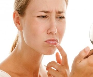 DUDAK UÇUKLATAN GERÇEK: STRES