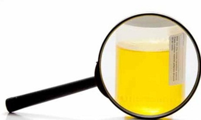 Eğer sürekli bir ilaç kullanmıyorsanız idrar rengi açıksa yeterli sıvı almışsınız demektir.