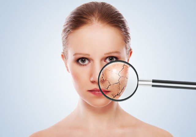 Kuru cilt en kötüsüdür. Çatlamanıza, kanamanıza ve kırışmanıza sebep olur.