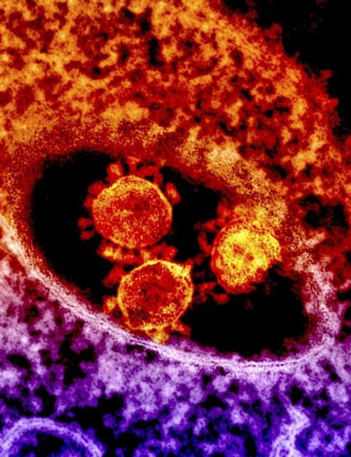 1-MERS nedir? - MERS yani Ortadoğu Solunum Yetmezliği Sendromu, viral bir solunum yolu hastalığı. -