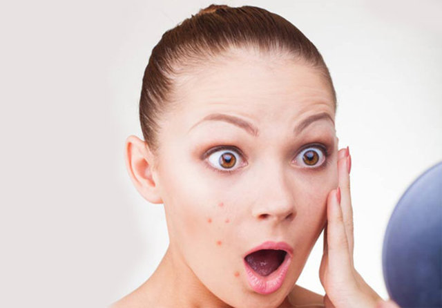 Aslında sarımsı renkte bir salgı olan sebum, sadece hava ile temas ettiğinde rengi oksidasyona bağlı olarak koyulaşıyor. -