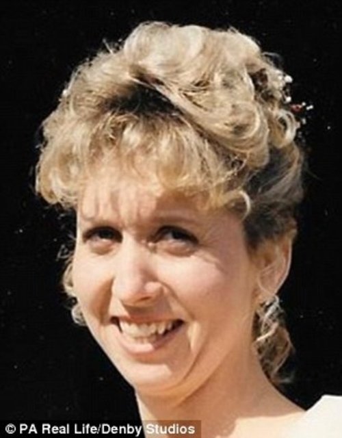 Dişlerinin dönüşmeye başladığı 2011 yılından beri doktorunun teşhis koyamadığı kadına en sonunda periodontal hastalıklar tanısı koyuldu.  -