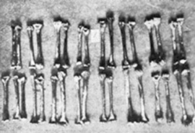 'Hanover Vampiri'olarak bilinen bu Alman, tarihteki ilk seri katillerden biridir.