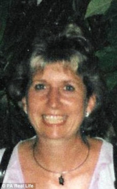 - 49 yaşındaki, Charlotte Bateman'a 2011 yılında periodontal hastalıklar tanısı koyuldu ve düzenli olarak doktor tedavisi uygulandı.  -