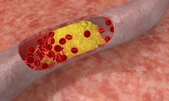 13. 'Kötü' kolestrol değerim 3.3 mmol/litrenin altında.